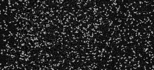 This image was taken from a thin layer near Stellwagen Bank offshore of Massachusetts, USA. Each one of the white particles is a copepod. The concentration of organisms in this image corresponds to ~400,000 individuals per cubic meter! That is some good eating for a right whale!